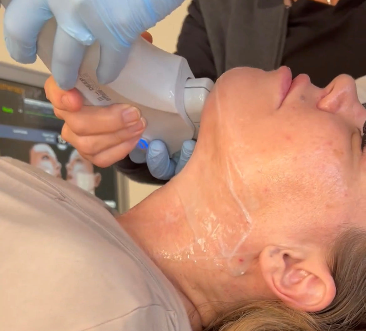 Non Surgical Ultrasound Therapy