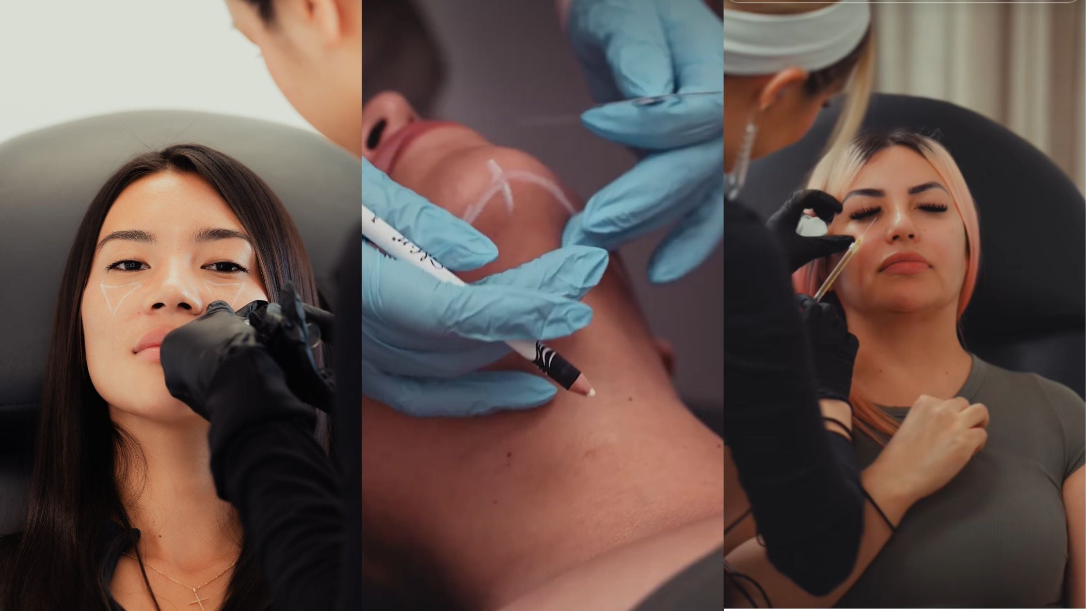 Non-Surgical Aesthetics in CA and AZ