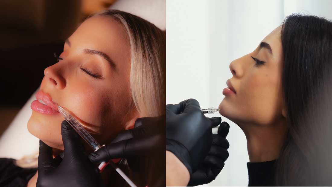 Filler Migration Fears: What's Real and What's Hype