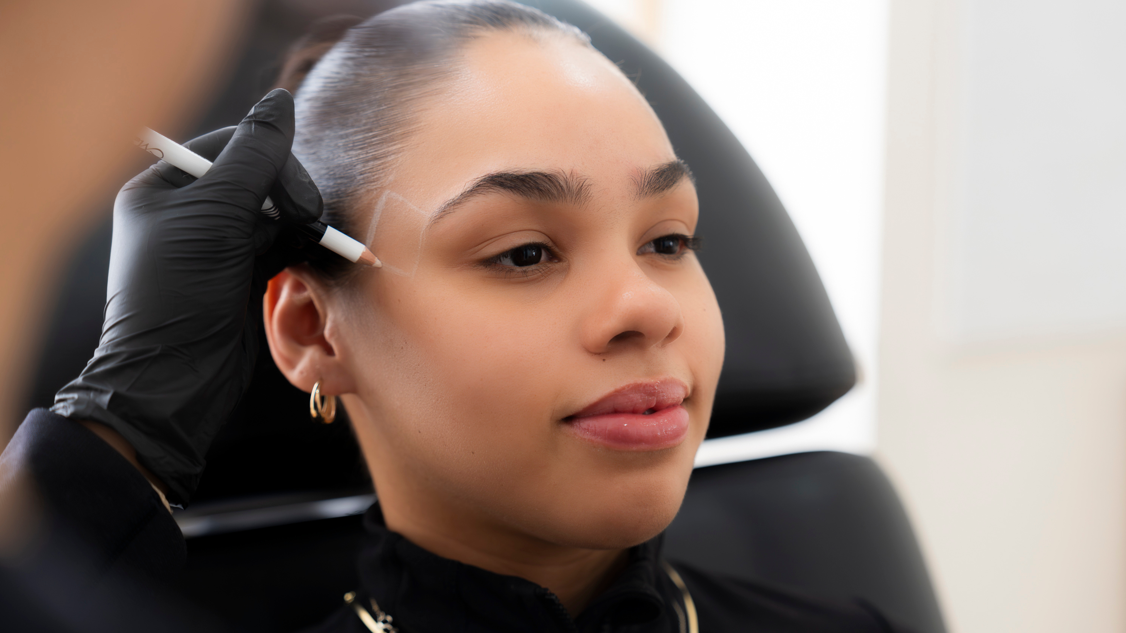 Temple Filler: The Treatment That Restores Volume and Lifts the Face