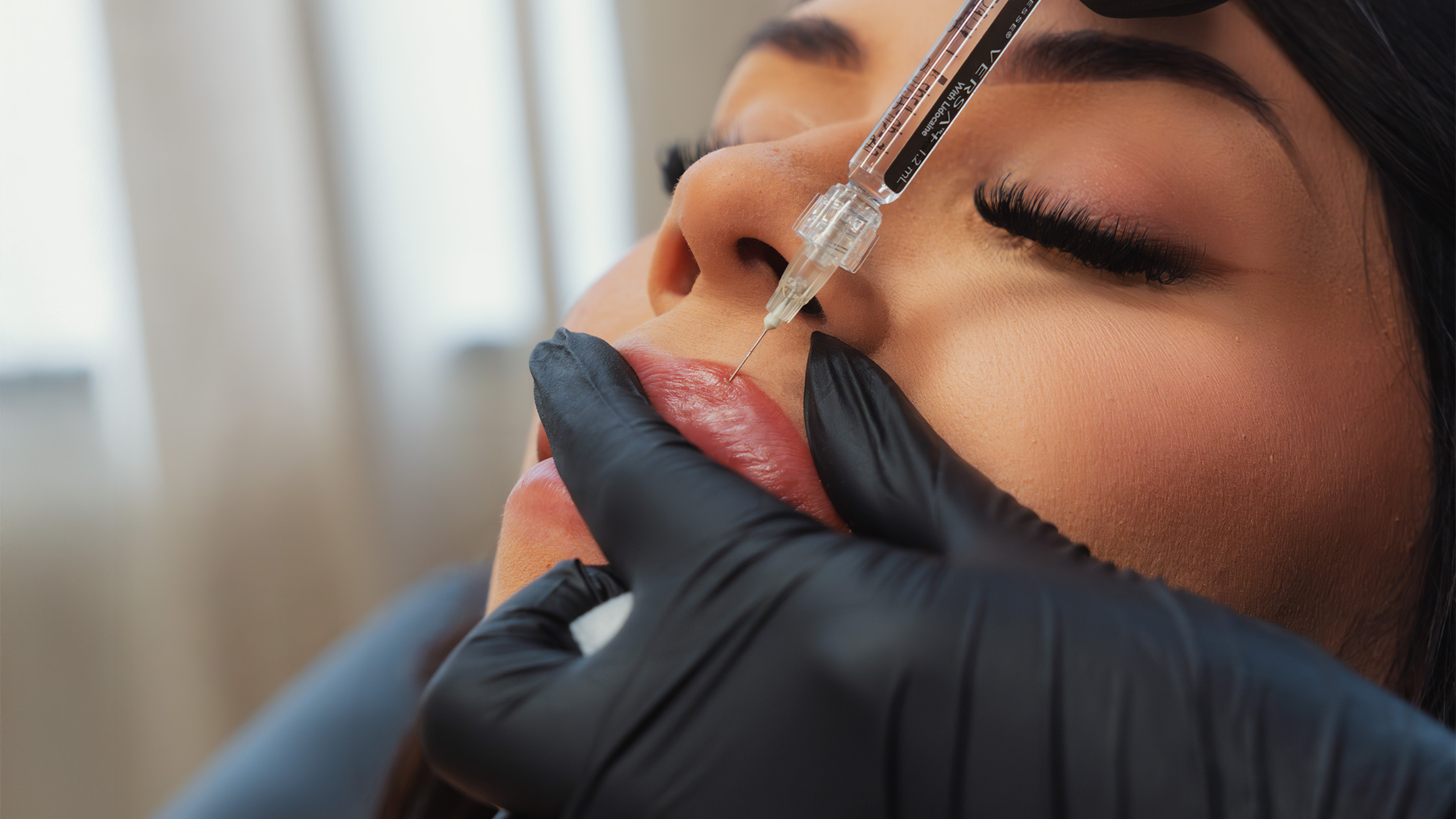 Dermal Fillers: The Art and Science of Natural Enhancement