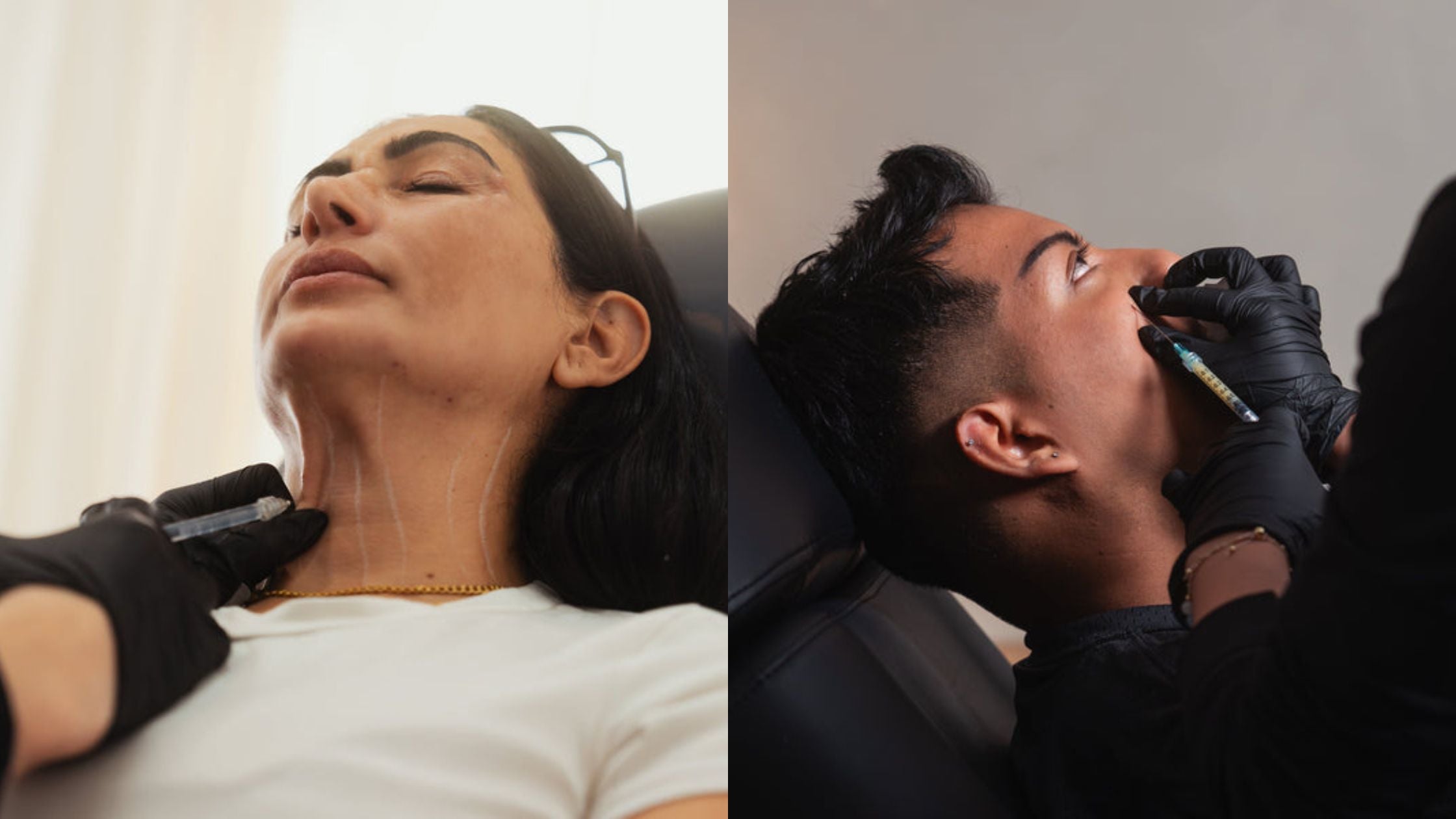 Understanding the Key Differences Between Radiesse and Traditional Dermal Fillers