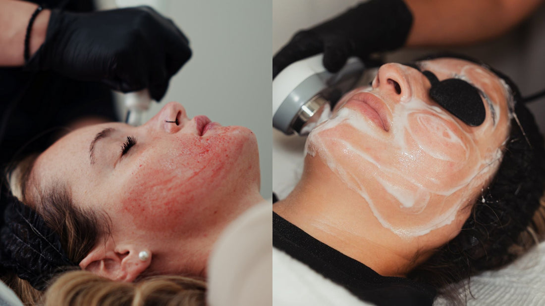 Understanding the Difference Between Professional Facials and Medical-Grade Treatments