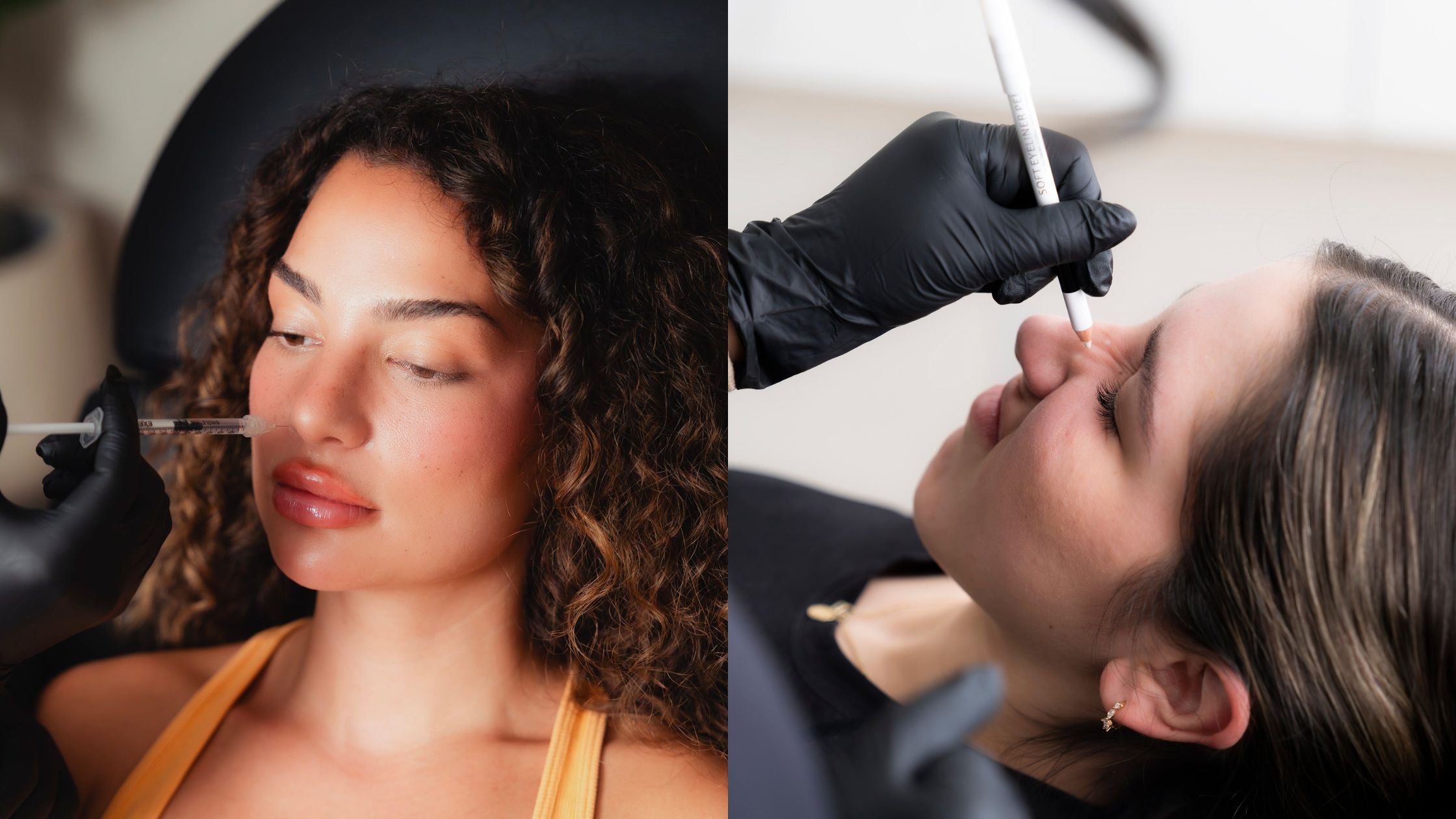 Natural-Looking Botox Results in San Jose, CA