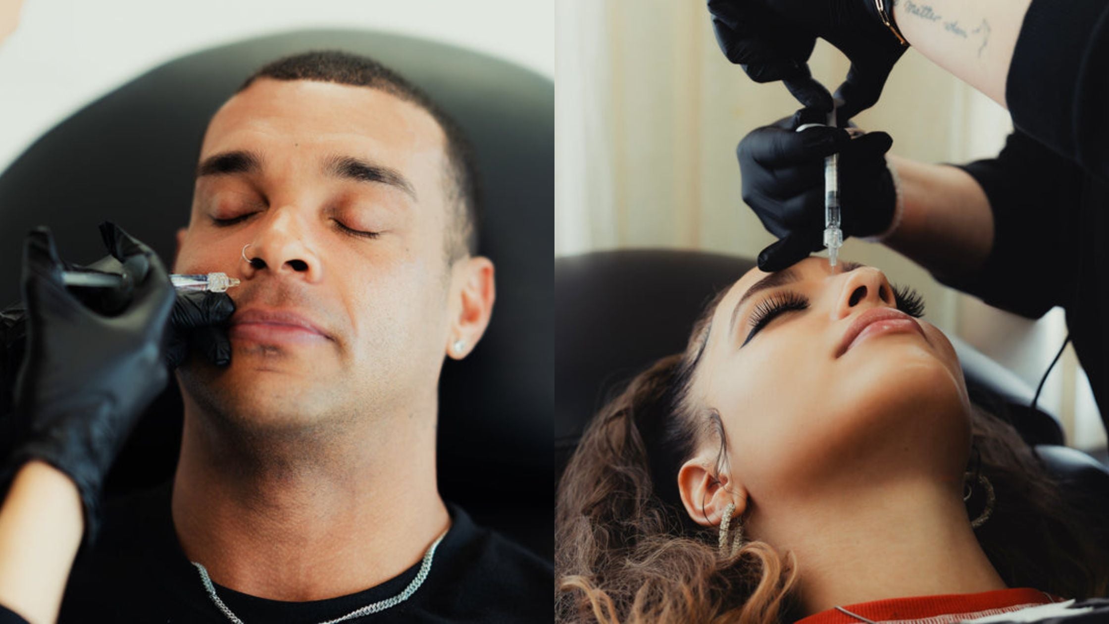 Understanding Dermal Fillers Work in San Jose, CA, and How They Work and What They Enhance