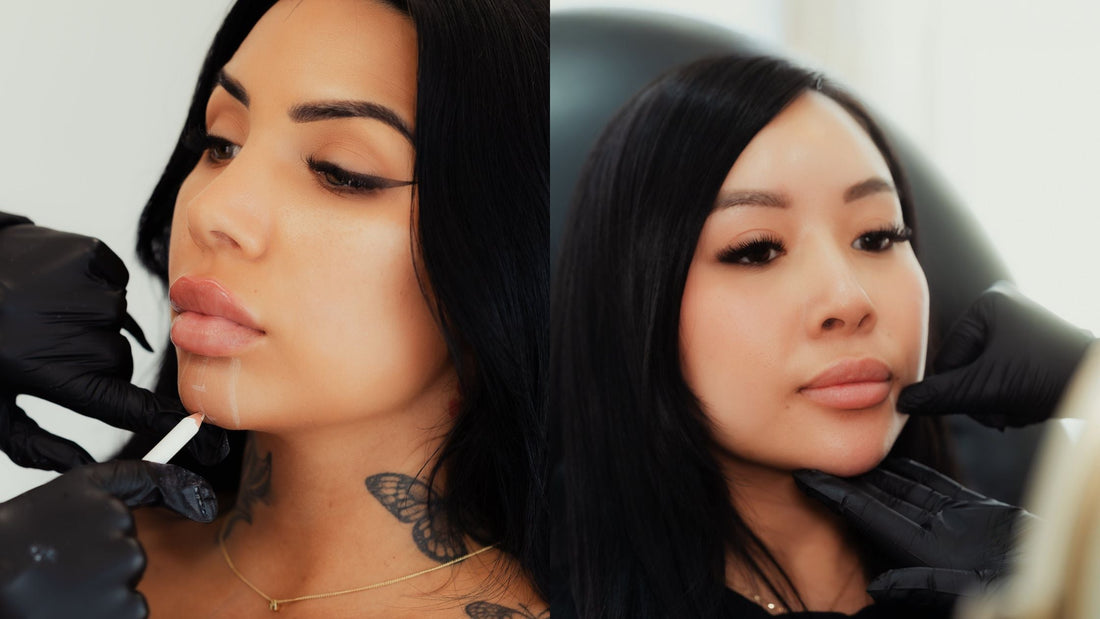 Sculptra Treatment in NakedMD Med Spa