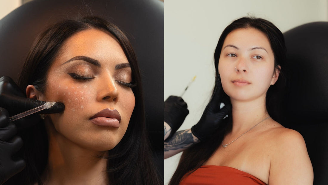 NakedMD Botox treatment