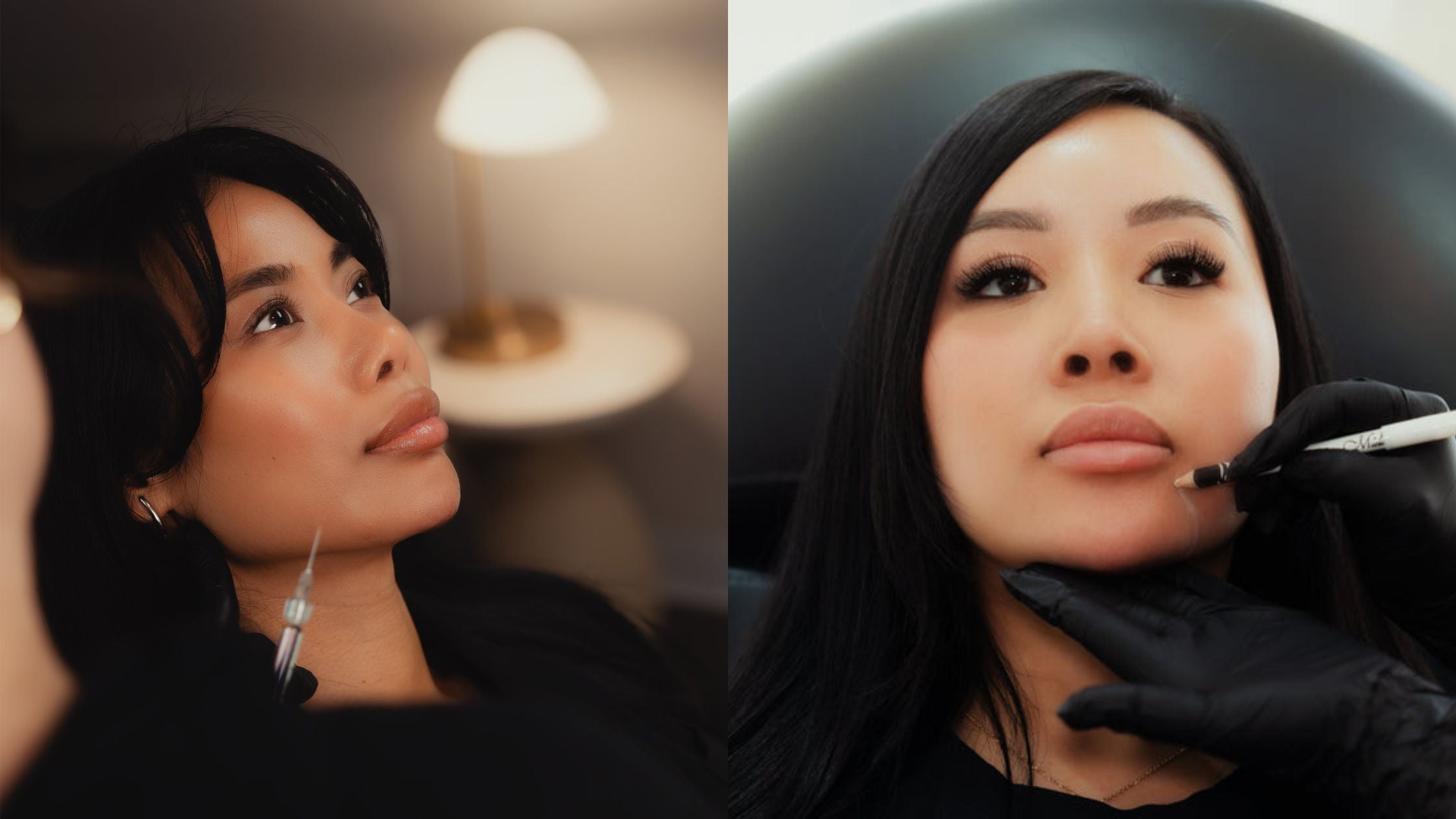 Thinking About Restylane® Filler in Tucson, AZ? Here’s What to Expect