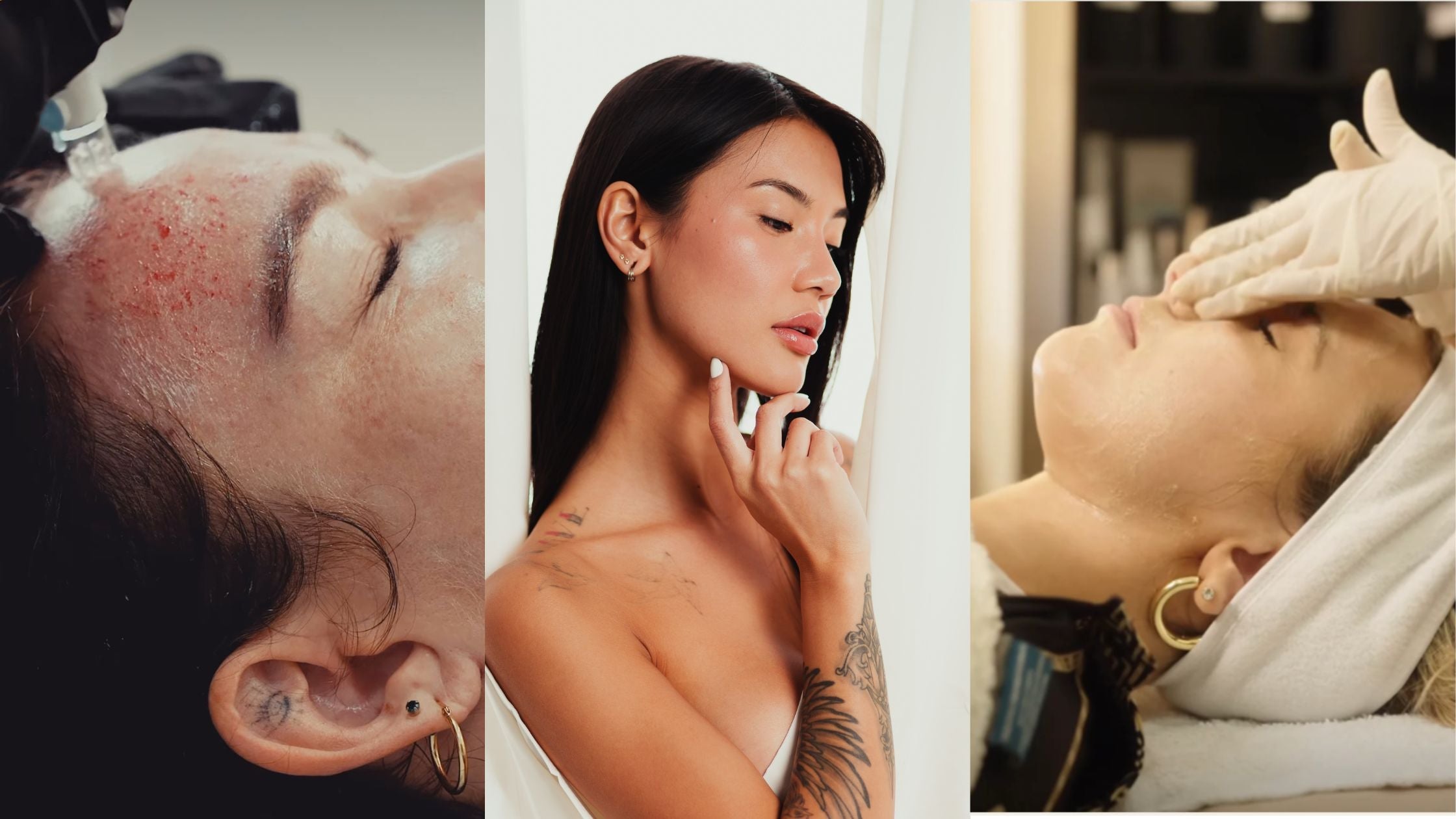 Anti-Aging Treatment in California and Arizona