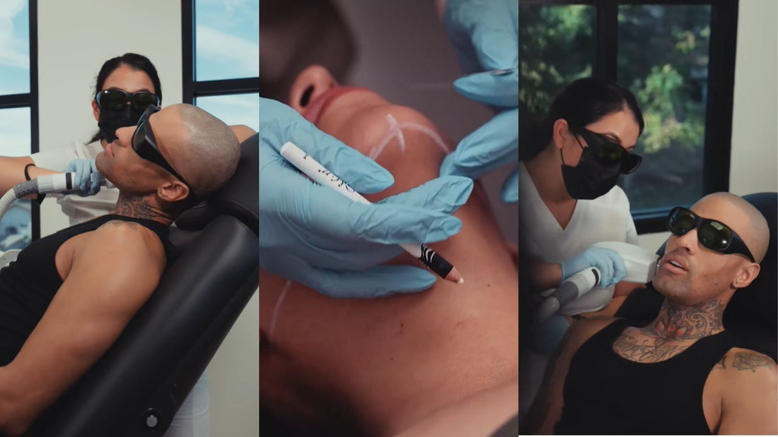 Ultherapy in West Covina, CA: The Secret to Faster Recovery and Better Skin