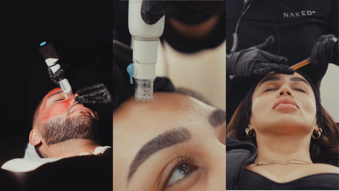 Microneedling Treatment in Scottsdale, AZ