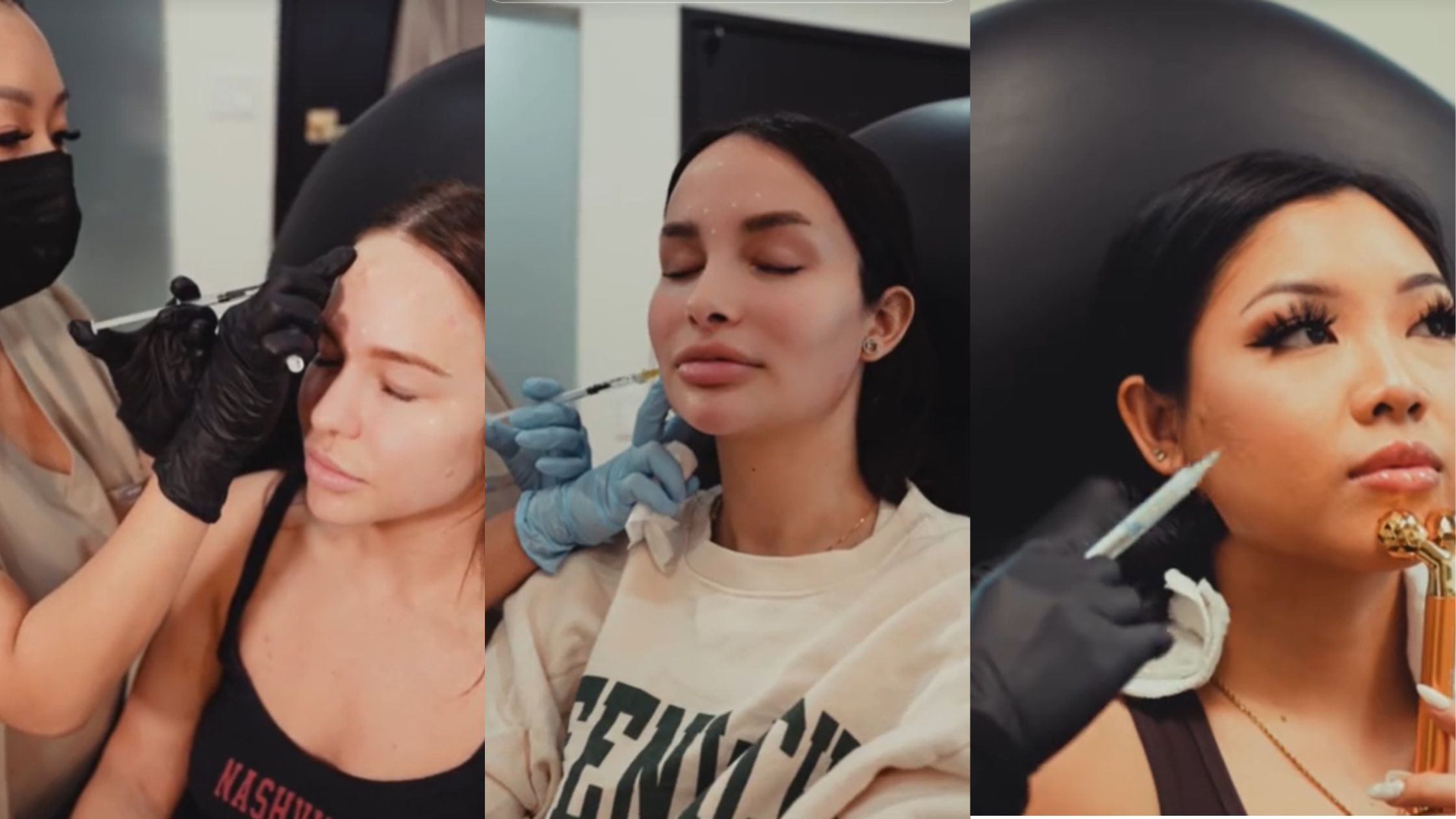 Fillers from NakedMD