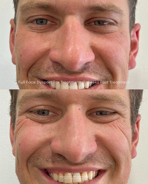 Naked TOX | Neurotoxins