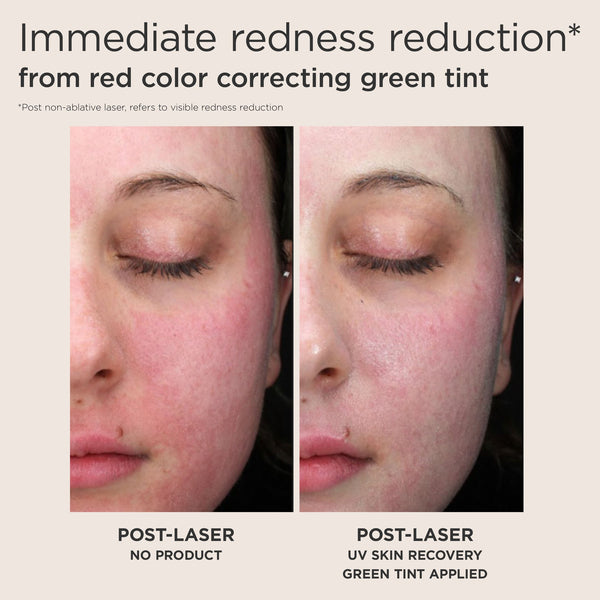 EltaMD UV Skin Recovery Green Tint