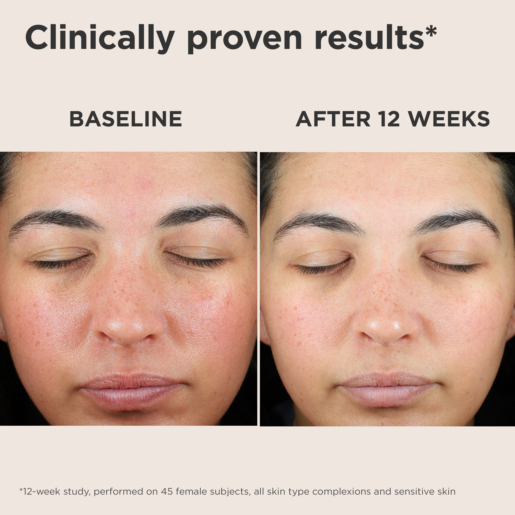 EltaMD UV Skin Recovery Green Tint