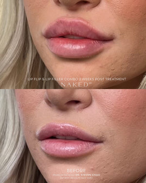 Naked Lips | Lip Filler - NV