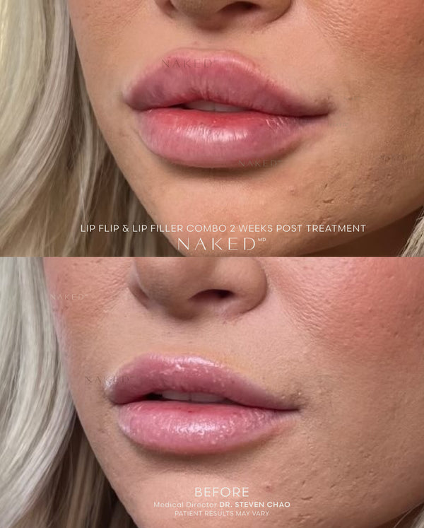 Naked Lips | Lip Filler - NV