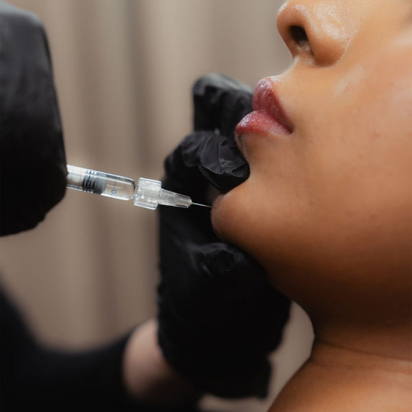 Chin Filler | New Client Offer