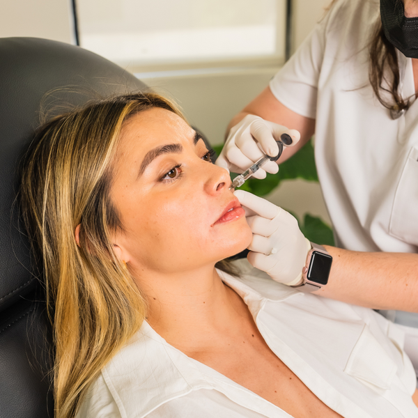 Smile Lines Filler | New Client Offer