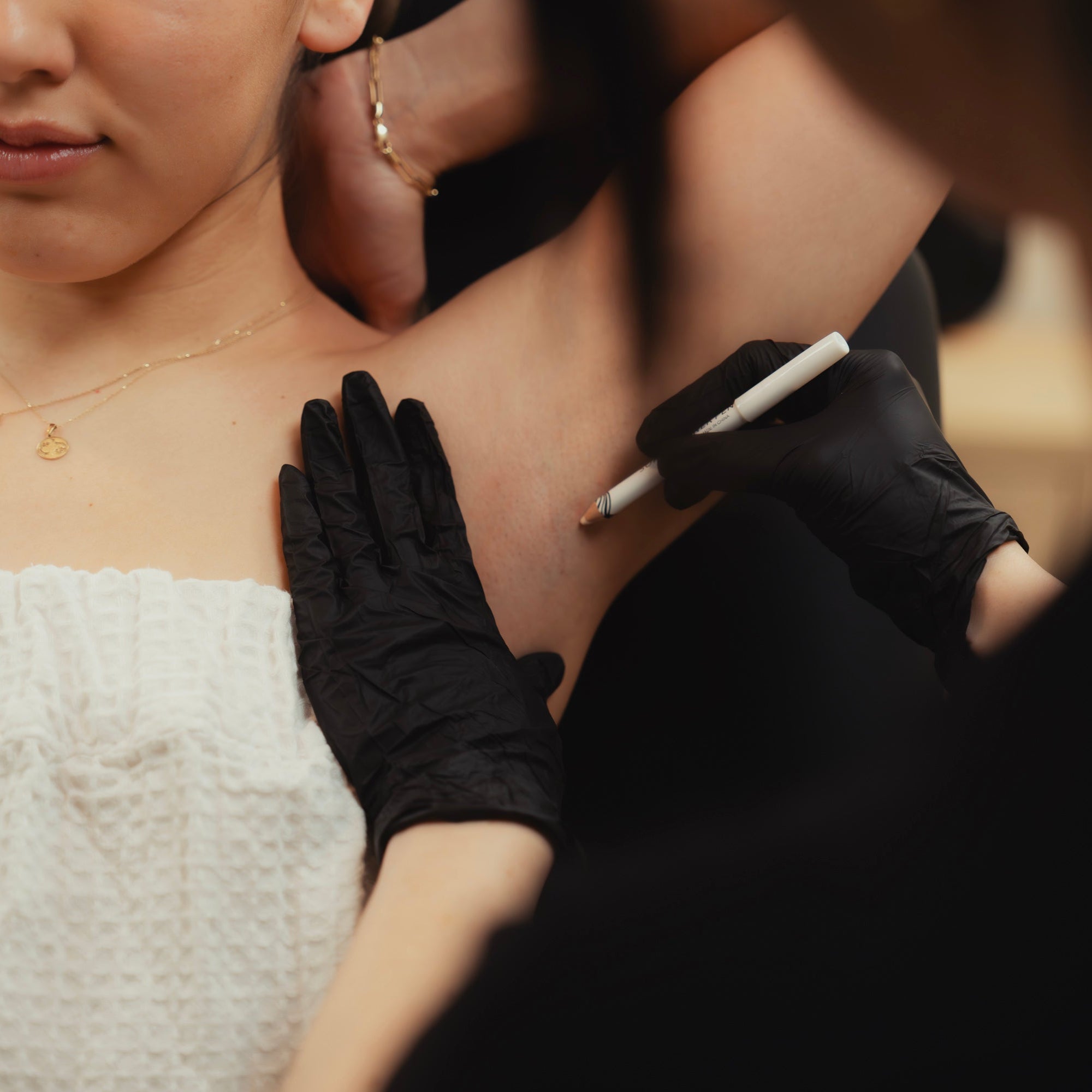 Underarm Sweating