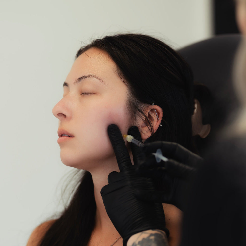 TOX | Slim Chin (Masseter)