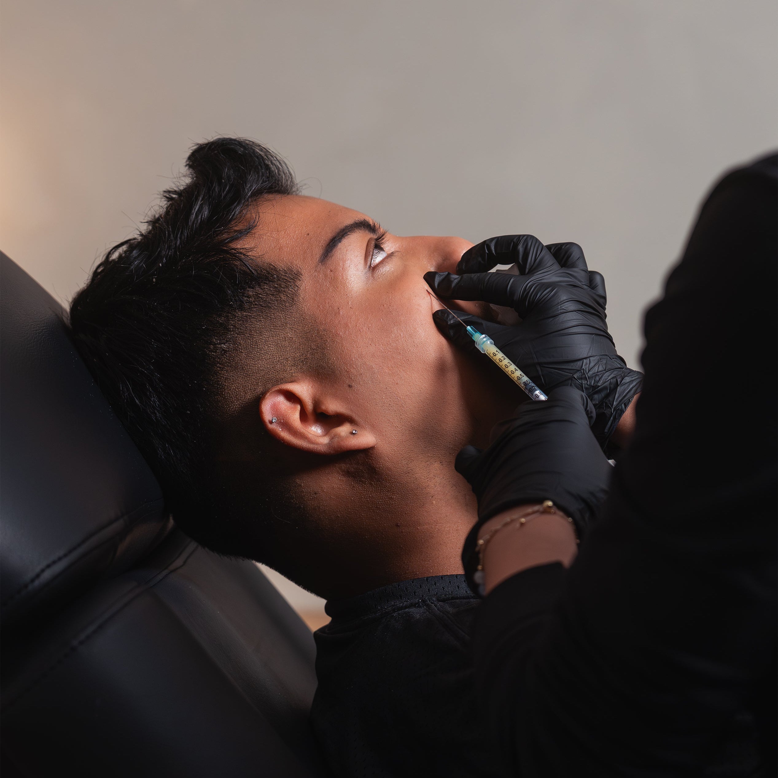 Undereye Filler