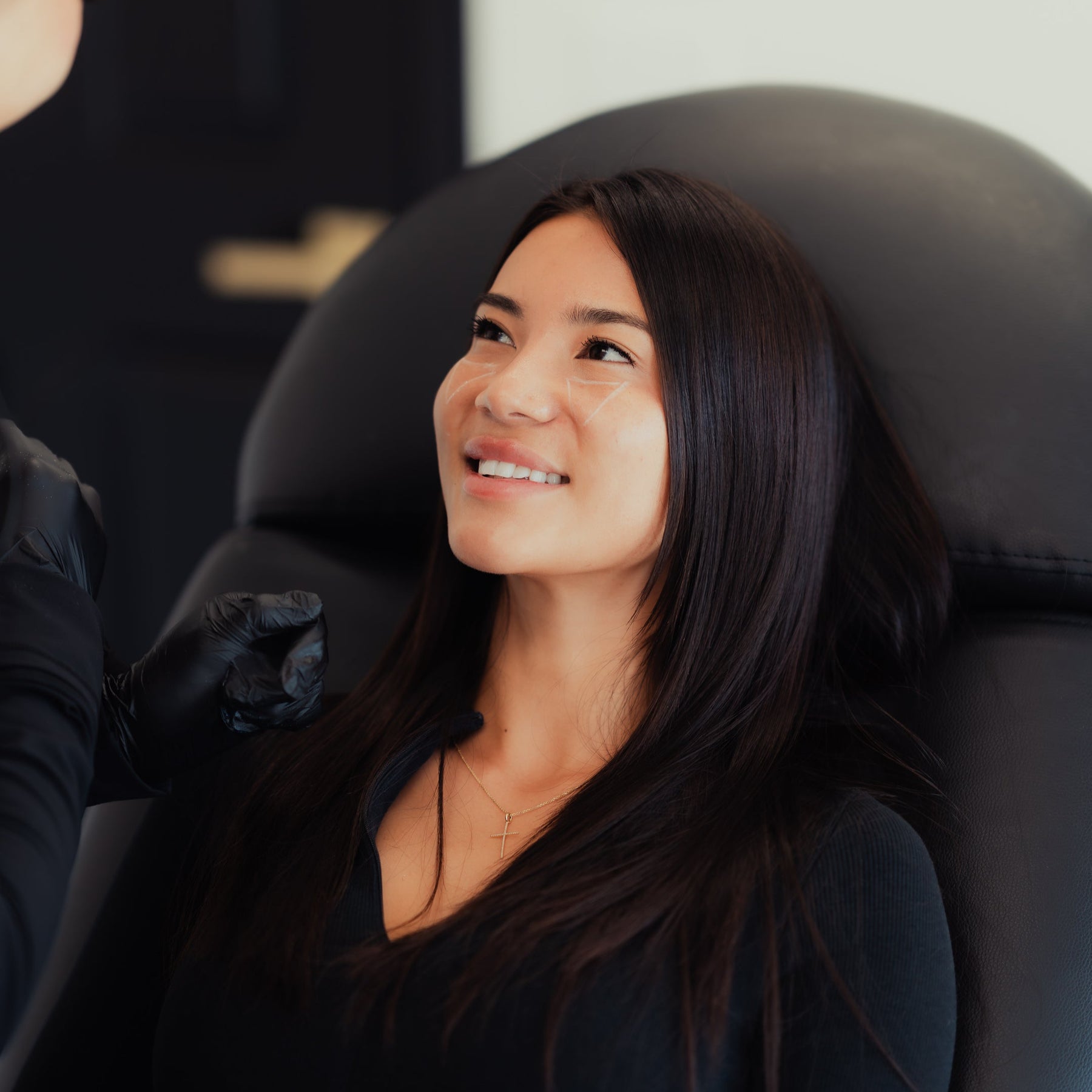 Cheek Filler | Dermal Filler Cheeks to Define Your Look โ NAKEDMD Medspa