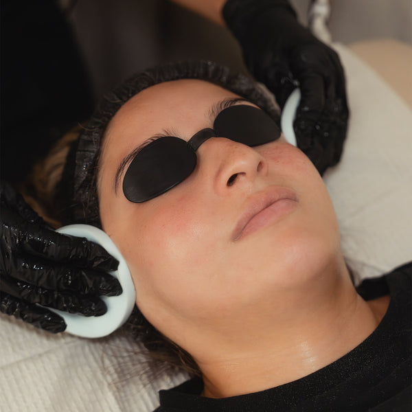 Perfect Derma Peel®