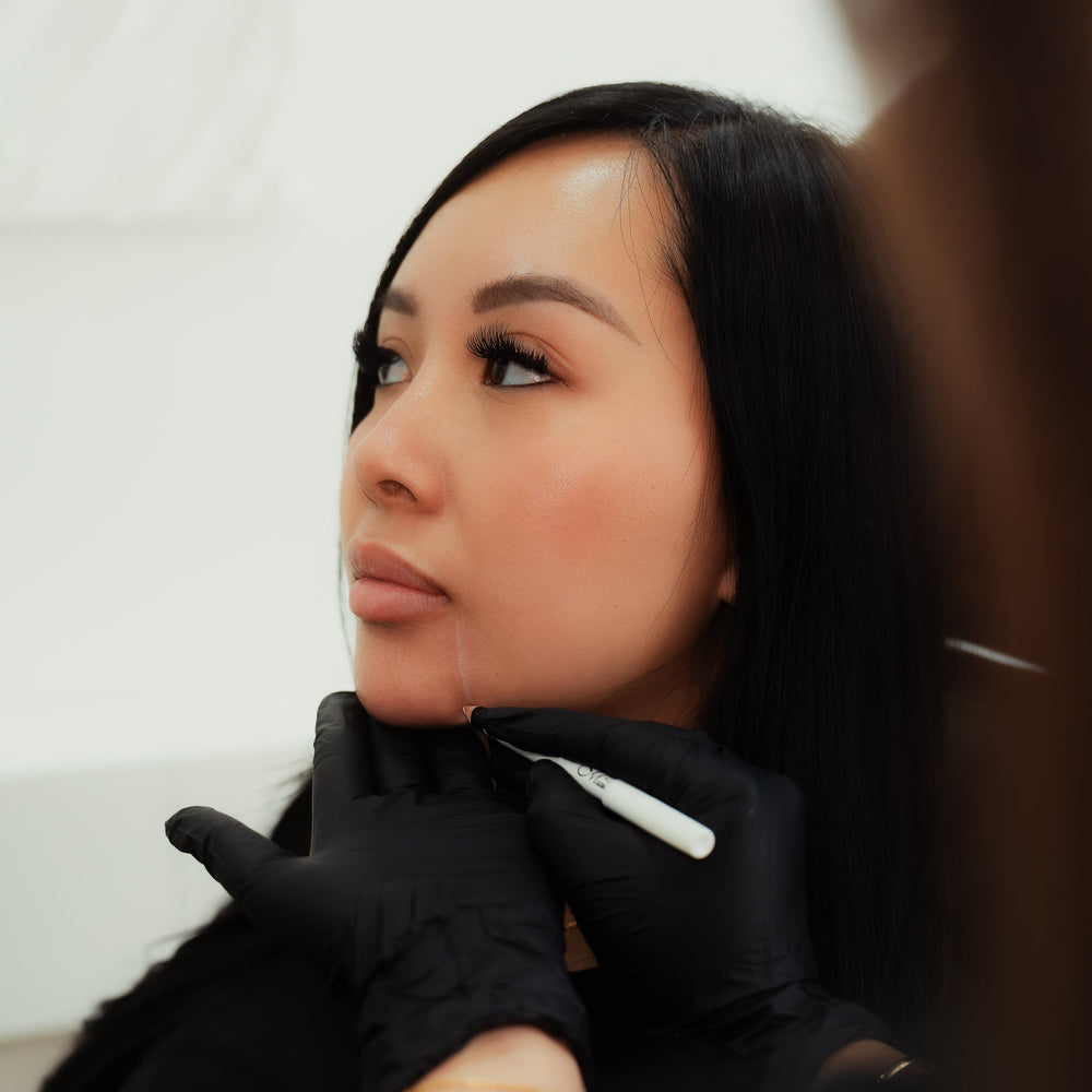 Marionette Lines Fillers