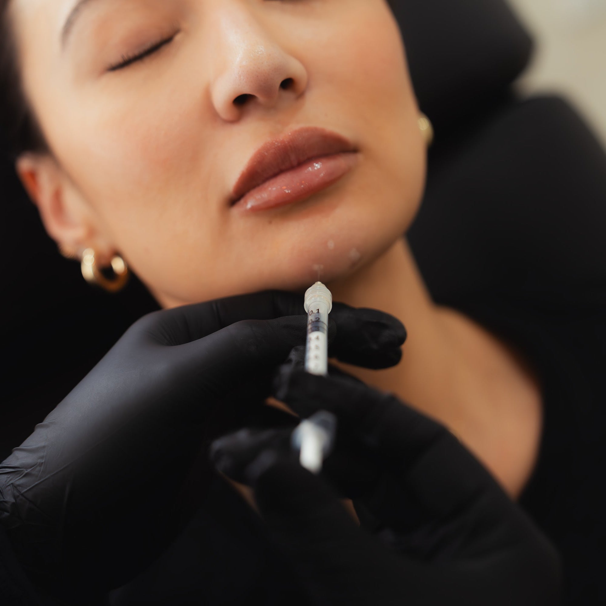 Chin Dimpling | Chin TOX Treatment for a Balanced Look
