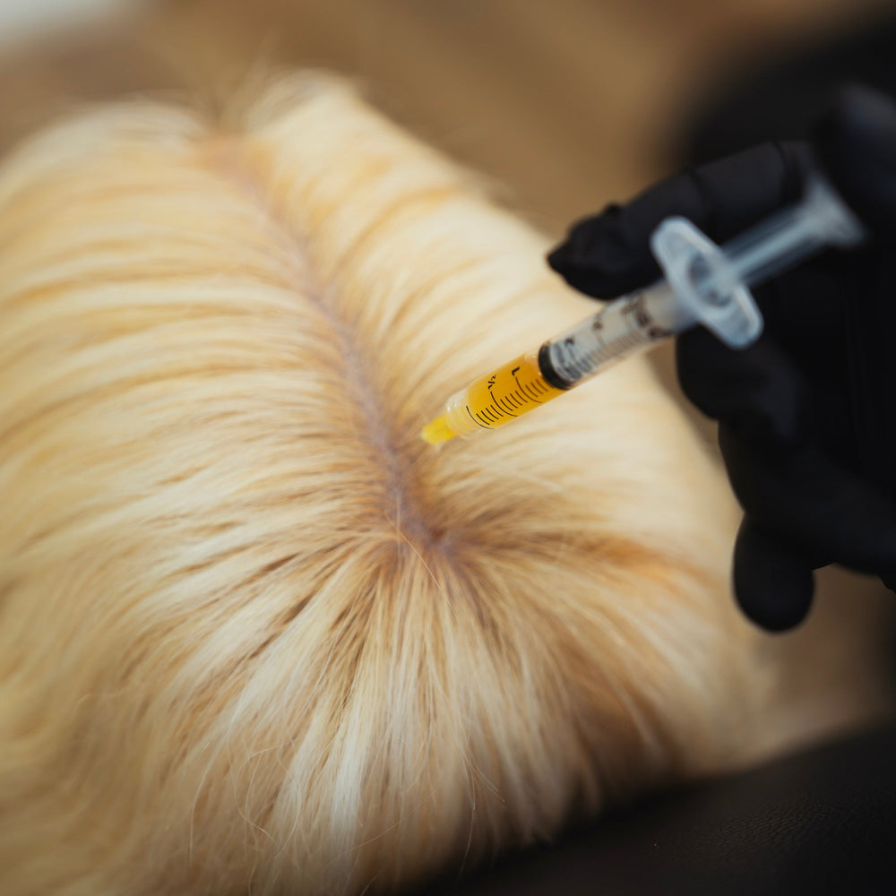 Hair Regrowth PRF (Platelet Rich Fibrin)