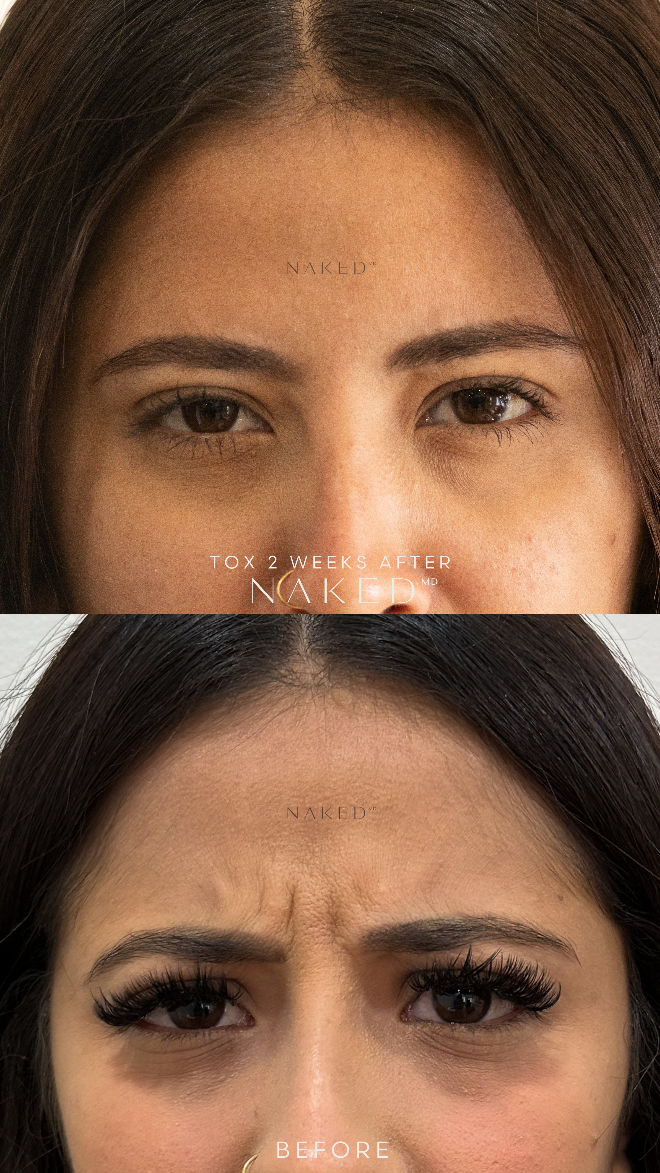 Naked TOX | 1st Time Patient Promo