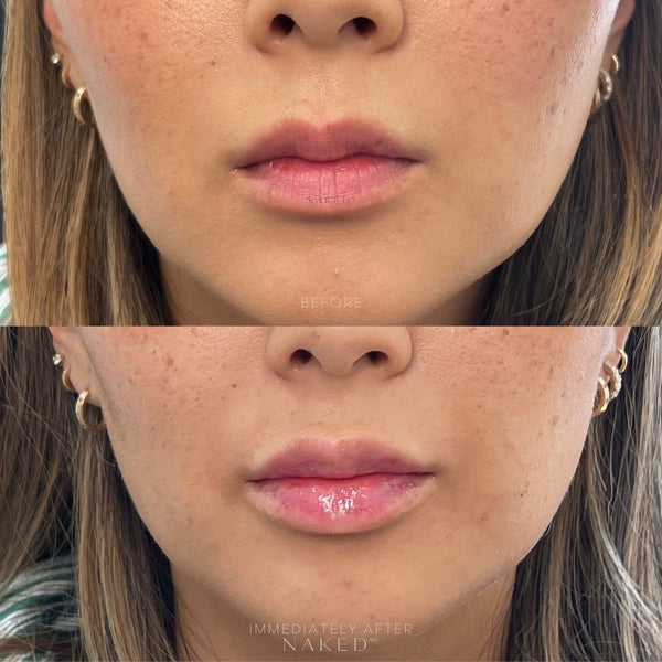 Naked Lips | Lip Filler - NV