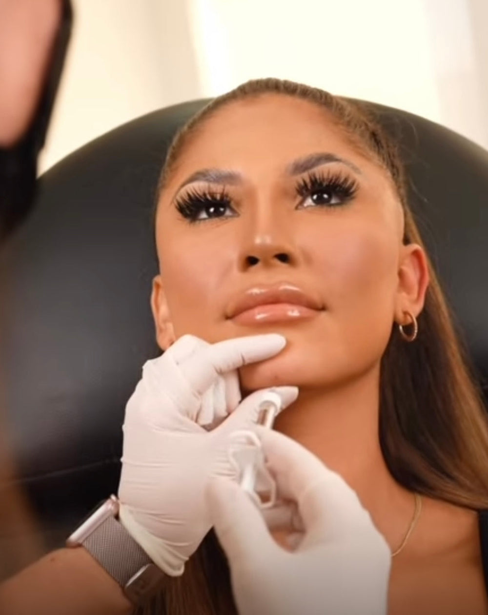 Chin Filler | New Client Offer