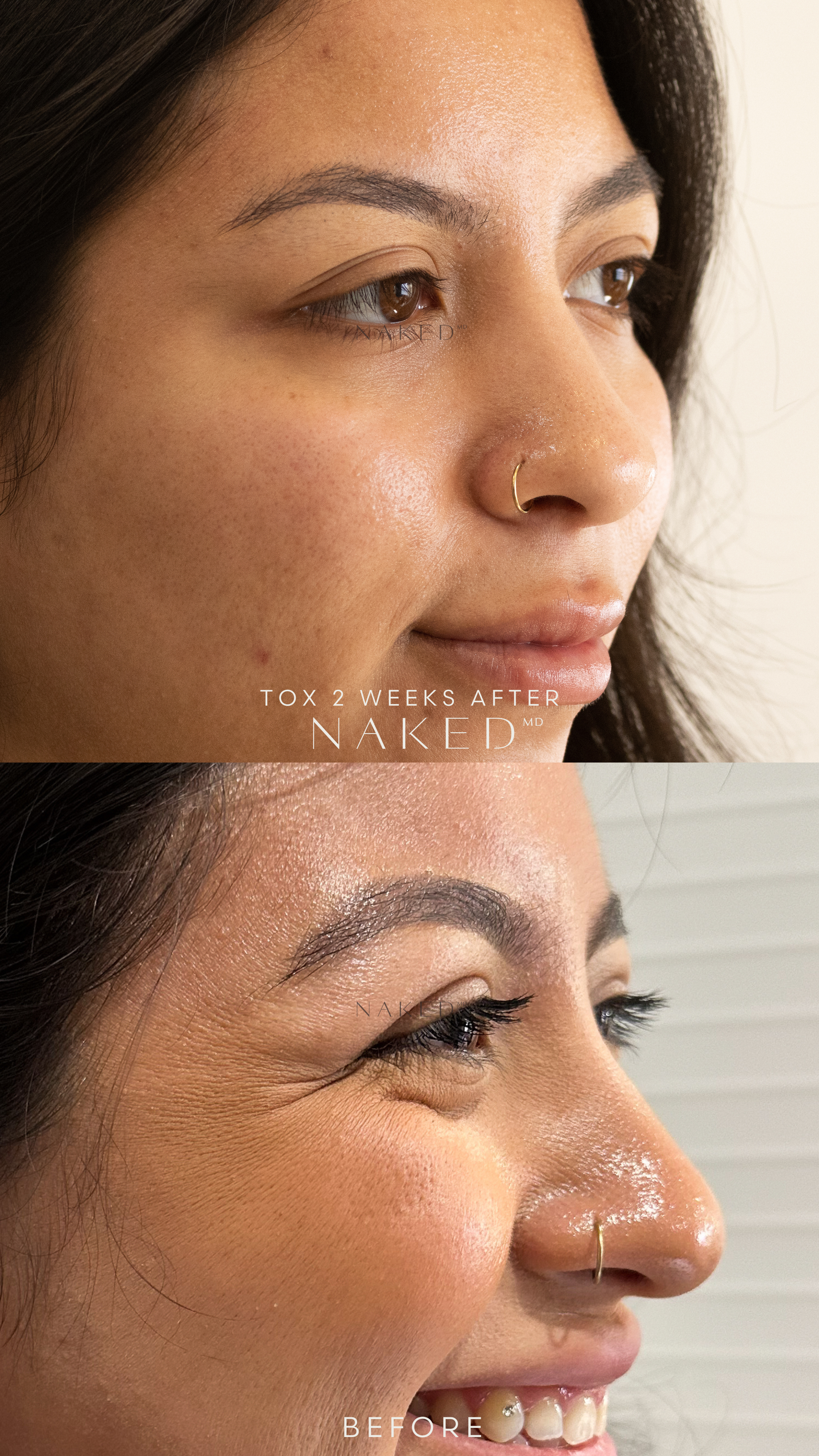 Naked TOX | 1st Time Patient Promo
