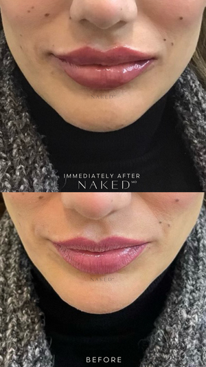Naked Lips | Lip Filler - NV