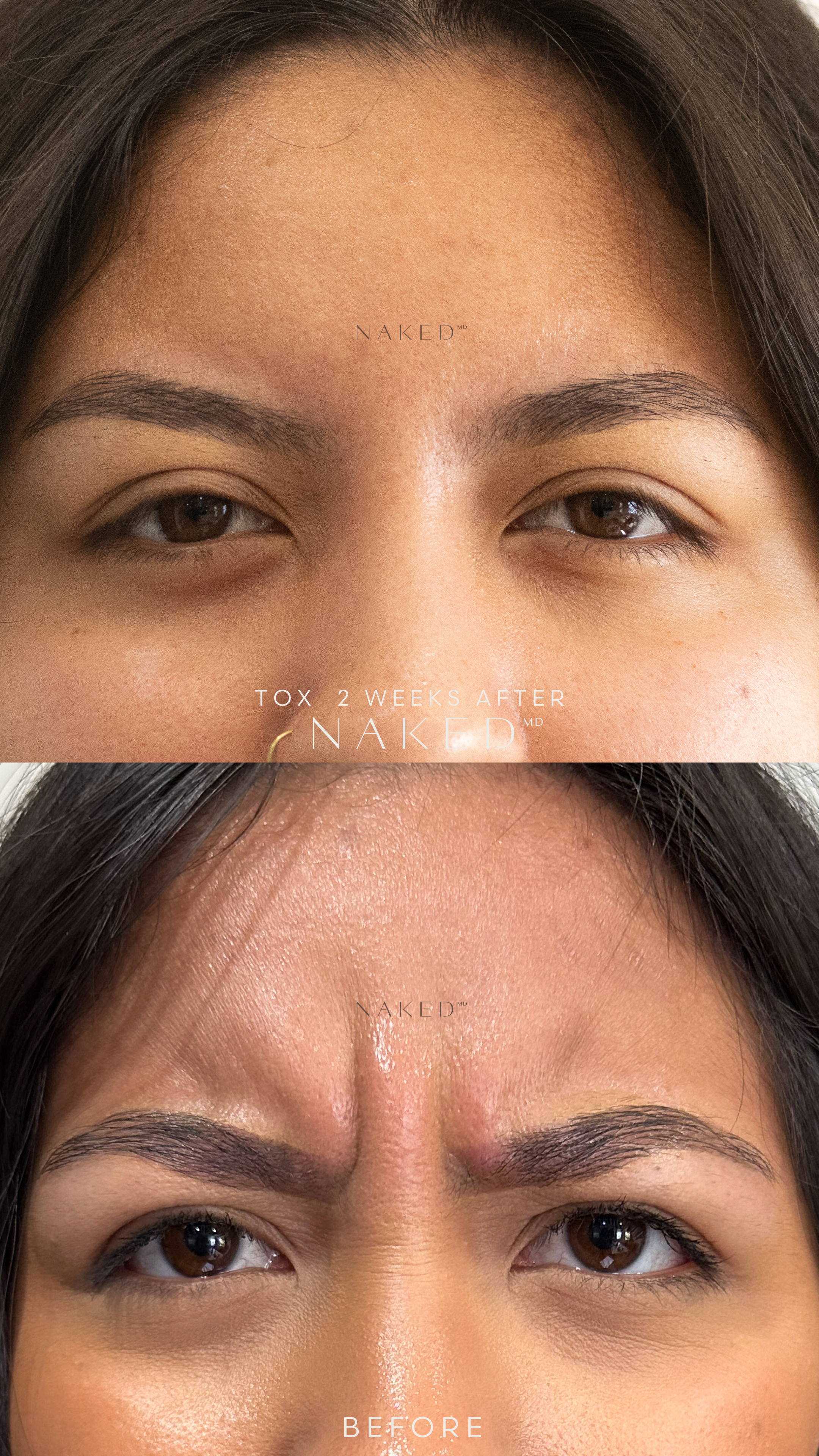 Naked TOX | 1st Time Patient Promo