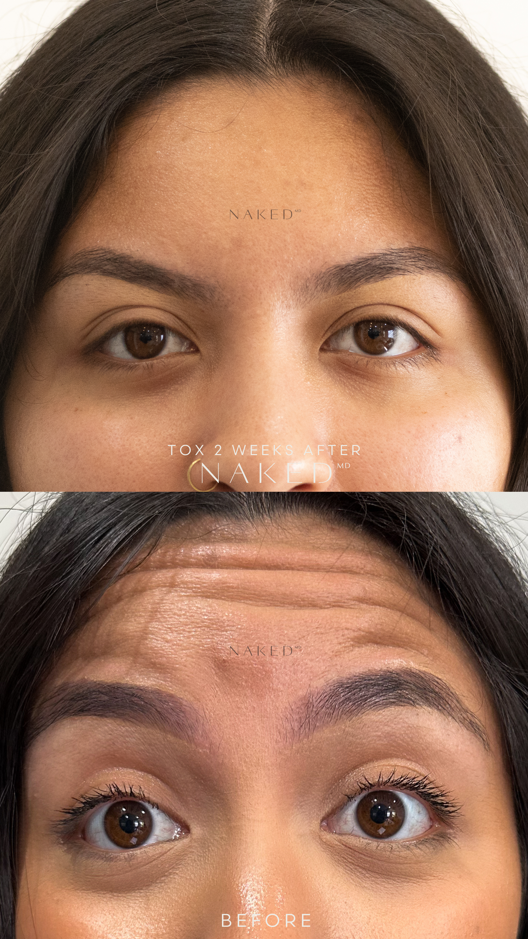 Naked TOX | 1st Time Patient Promo