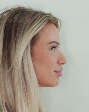 Naked Nose | Non-Surgical Nose Job (NSNJ)