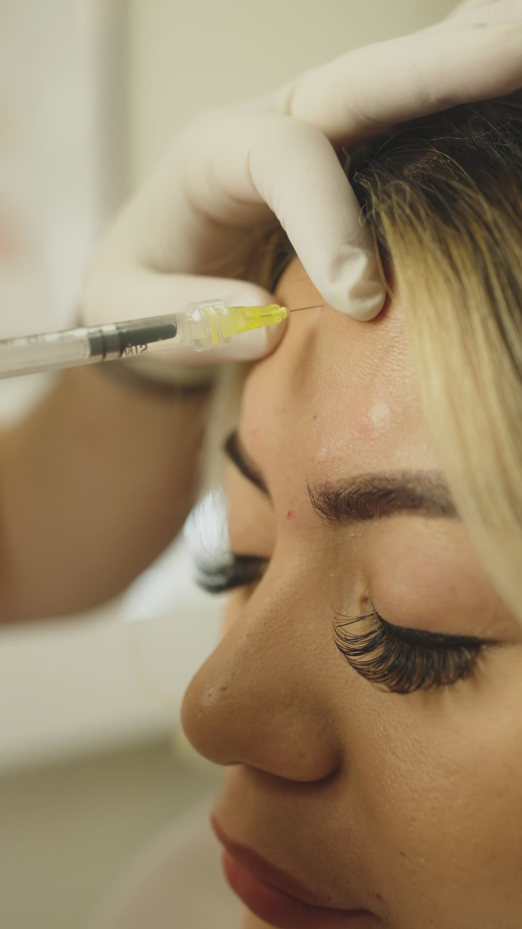 Forehead Neurotoxin | Tox Treatment