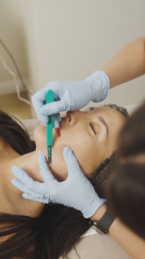 Dermaplaning