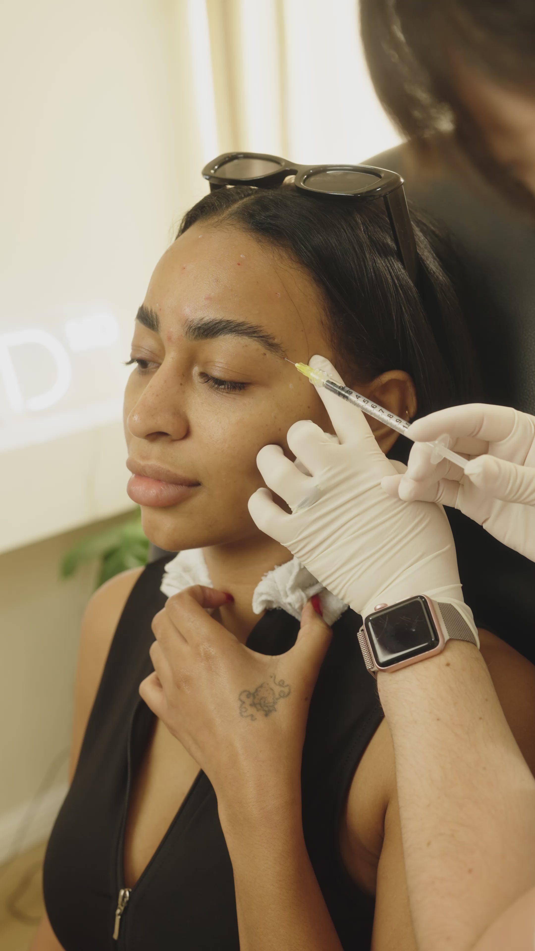 Crows Feet Neurotoxin | Tox Treatment
