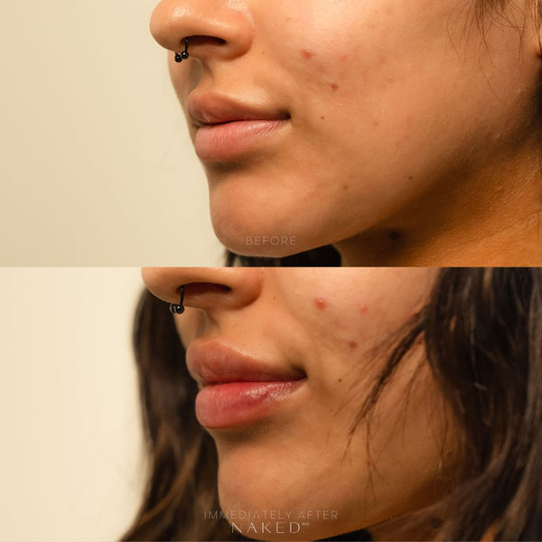 Naked Lips | Lip Filler - NV