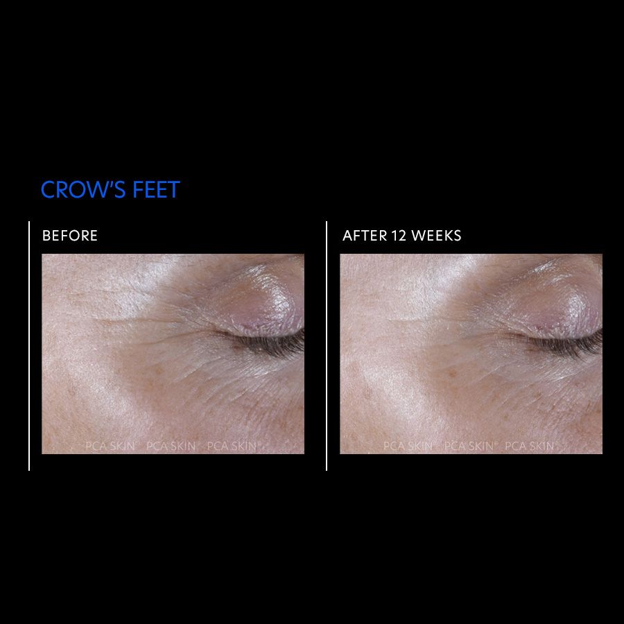 ExLinea® Pro Peptide Serum