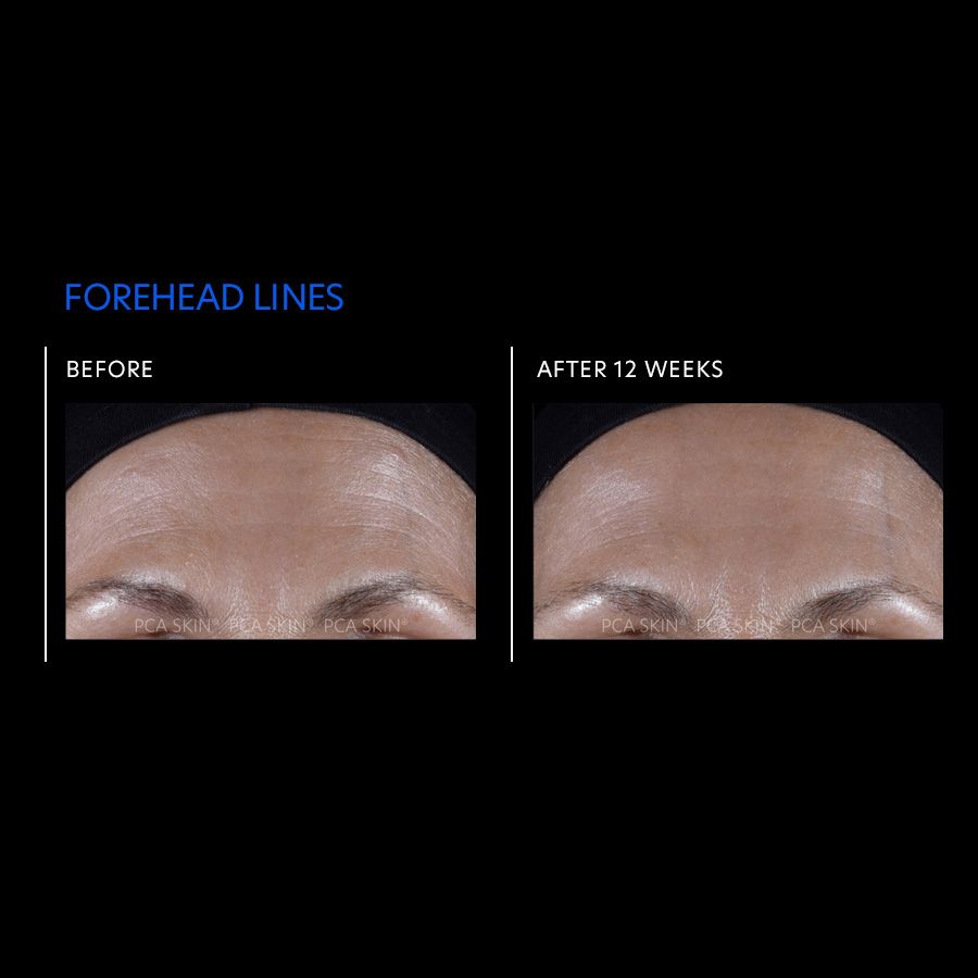 ExLinea® Pro Peptide Serum