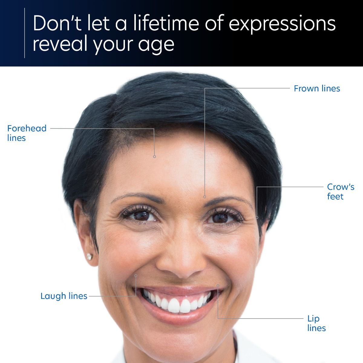 ExLinea® Pro Peptide Serum