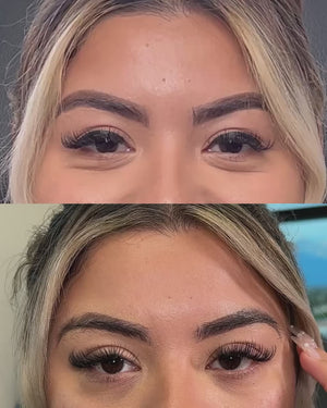 Naked TOX | Neurotoxins