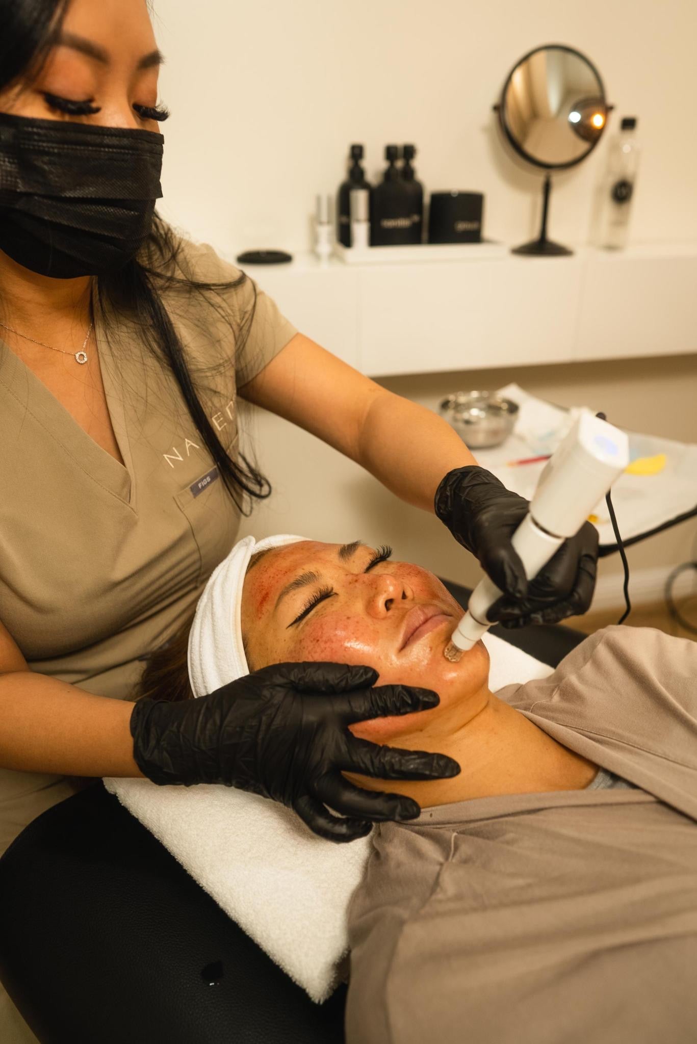 Microneedling + Options