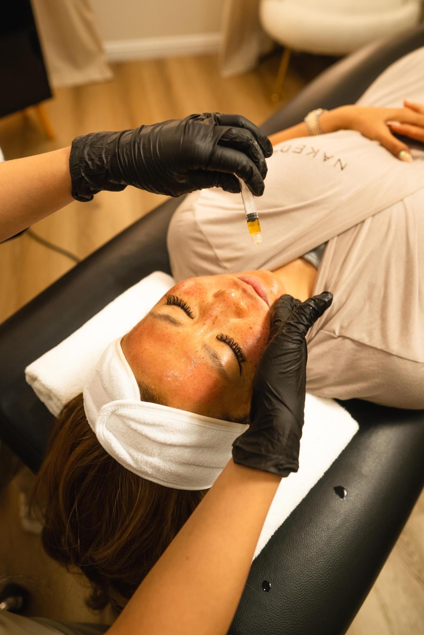 Microneedling w/ SkinPen