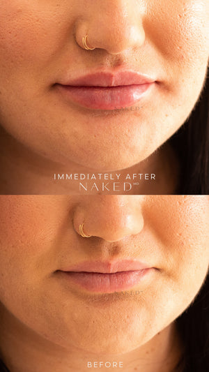 Naked Lips | Lip Filler - NV